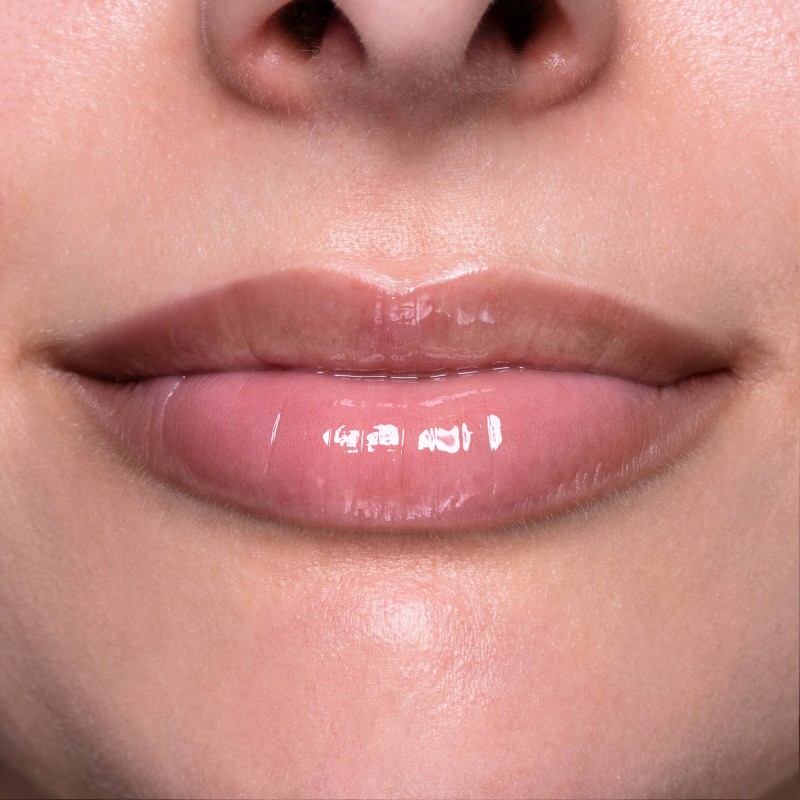 Sirenetta - immagine 5