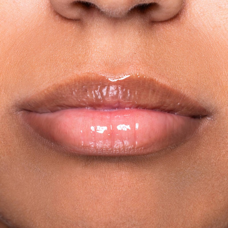 Sirenetta - immagine 6